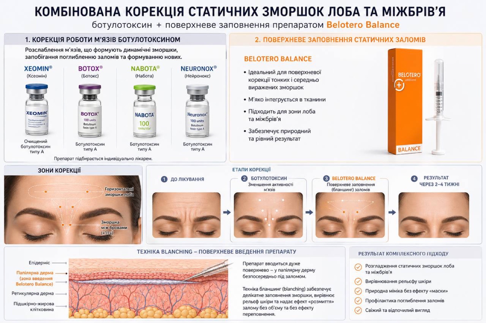 Корекція зморшок міжбрів'я та лоба — результат лікування в Dermedem, Львів